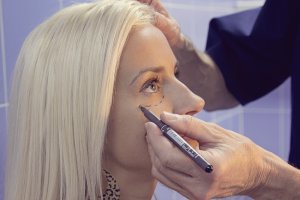 Patientin beim Einzeichnen vor Augenlidstraffung - Tränensäcke entfernen in Ungarn - Super Preise!